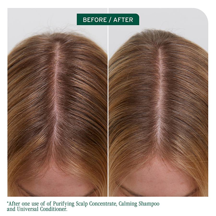 Biolage | Scalp Sync Purifying Concentrate (200ml)