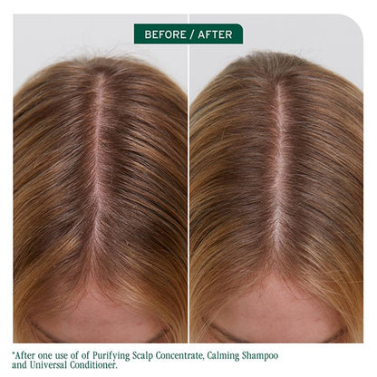Biolage | Scalp Sync Purifying Concentrate (200ml)